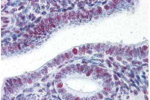 Human Uterus (formalin-fixed, paraffin-embedded) stained with HSF1 antibody ABIN337399 at 5 ug/ml followed by biotinylated goat anti-rabbit IgG secondary antibody ABIN481713, alkaline phosphatase-streptavidin and chromogen. (HSF1 antibody)