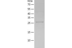 Western Blotting (WB) image for Thioredoxin-Like 1 (TXNL1) (AA 1-289) protein (His tag) (ABIN7284432) (TXNL1 Protein (AA 1-289) (His tag))