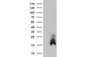 HEK293T cells were transfected with the pCMV6-ENTRY control (Left lane) or pCMV6-ENTRY DUSP23 (Right lane) cDNA for 48 hrs and lysed. (DUSP23 antibody)