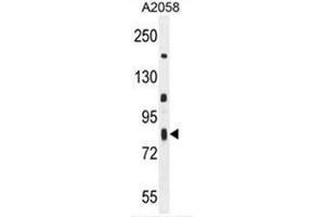 C6orf70 Antibody (Center) western blot analysis in A2058 cell line lysates (35µg/lane). (C6orf70 antibody  (Middle Region))