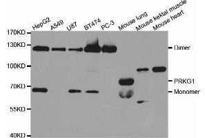Western blot analysis of extracts of various cell lines, using PRKG1 antibody (ABIN5971390) at 1/1000 dilution. (PRKG1 antibody)