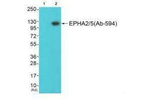 Western blot analysis of extracts from JK cells (Lane 2), using EPHA2/5 (Ab-594) antiobdy. (EPHA2/EPHA5 (Tyr594) antibody)