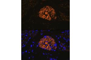 Immunofluorescence analysis of mouse bladder using Cytokeratin 13 (KRT13) (KRT13) Rabbit mAb (ABIN7268089) at dilution of 1:100 (40x lens). (Cytokeratin 13 antibody)