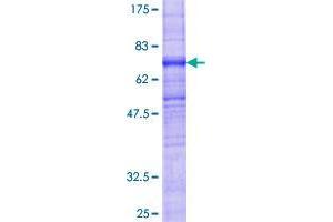 Image no. 1 for Zinc Finger, DHHC-Type Containing 6 (ZDHHC6) (AA 1-409) protein (GST tag) (ABIN1325701) (ZDHHC6 Protein (AA 1-409) (GST tag))