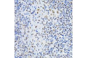 Immunohistochemistry of paraffin-embedded rat spleen using PTBP1 antibody  at dilution of 1:100 (40x lens). (PTBP1 antibody  (AA 1-290))