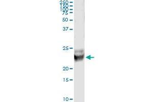 Immunoprecipitation of RAB7B transfected lysate using anti-RAB7B monoclonal antibody and Protein A Magnetic Bead , and immunoblotted with RAB7B MaxPab rabbit polyclonal antibody. (RAB7B antibody  (AA 100-199))