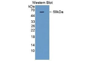 Western Blotting (WB) image for anti-Fms-Related tyrosine Kinase 1 (VEGFR1) (FLT1) (AA 167-424) antibody (ABIN3210071) (FLT1 antibody  (AA 167-424))