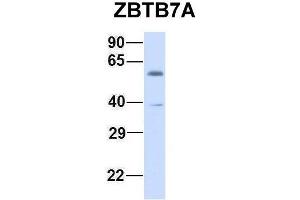 Host:  Rabbit  Target Name:  ZBTB7A  Sample Type:  Human Fetal Muscle  Antibody Dilution:  1. (ZBTB7A antibody  (N-Term))