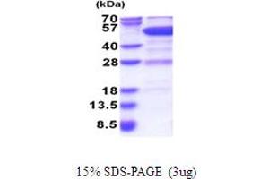 SDS-PAGE (SDS) image for GDP Dissociation Inhibitor 2 (GDI2) (AA 1-445) protein (His tag) (ABIN6387420) (GDI2 Protein (AA 1-445) (His tag))