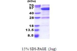SDS-PAGE (SDS) image for GDP Dissociation Inhibitor 2 (GDI2) (AA 1-445) protein (His tag) (ABIN5778003)