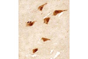 Immunohistochemistry (Paraffin-embedded Sections) (IHC (p)) image for anti-TANK-Binding Kinase 1 (TBK1) (AA 150-181) antibody (ABIN392371)