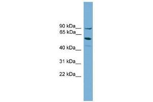ALOX15B antibody used at 0. (ALOX15B antibody  (Middle Region))