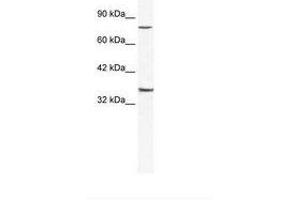 Image no. 1 for anti-Zinc Finger Protein 337 (ZNF337) (AA 288-337) antibody (ABIN202900) (ZNF337 antibody  (AA 288-337))