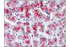 Immunohistochemistry (IHC) image for anti-Ribonuclease/angiogenin Inhibitor 1 (RNH1) (AA 7-461) antibody (ABIN400852) (RNH1 antibody  (AA 7-461))