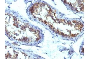Immunohistochemistry (IHC) image for anti-Alkaline Phosphatase, Liver/bone/kidney (ALPL) antibody (ABIN6939448)