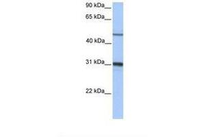 Image no. 1 for anti-Epoxide Hydrolase 1, Microsomal (Xenobiotic) (EPHX1) (AA 182-231) antibody (ABIN6738923)