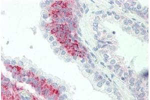 Human Prostate: Formalin-Fixed, Paraffin-Embedded (FFPE) (PAK4 antibody  (AA 187-216))
