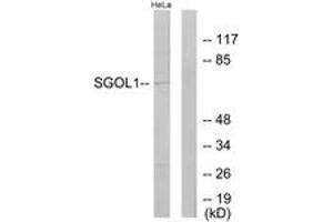 Western blot analysis of extracts from HeLa cells, using SGOL1 Antibody.