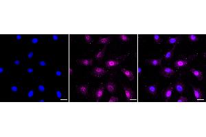 Immunocytochemical staining of C2C12 cells with Phospho-AKT1 (S124) antibody (ABIN7800784), 1:1,000). (Recombinant AKT1 antibody  (pSer124))