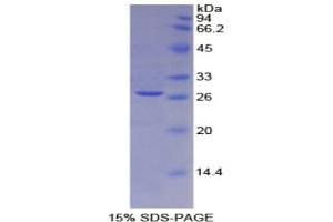 SDS-PAGE of Protein Standard from the Kit  (Highly purified E. (CD25 ELISA Kit)