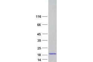 Validation with Western Blot (Chromosome 3 Open Reading Frame 60 (c3orf60) (Transcript Variant 3) protein (Myc-DYKDDDDK Tag))