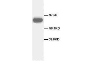 Western blot analysis of rat spleen sections using CD71 antibody (Transferrin Receptor antibody  (C-Term))