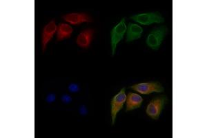 ABIN6264766 and ABIN6277226 staining Hela cells by IF/ICC.