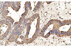IHC analysis of PDIA6 using anti-PDIA6 antibody (ABIN7600554). (PDIA6 antibody  (AA 20-440))