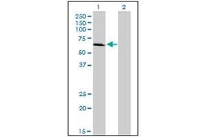 Western Blotting (WB) image for anti-Interleukin-1 Receptor-Associated Kinase 1 (IRAK1) (AA 530-693) antibody (ABIN614625) (IRAK1 antibody  (AA 530-693))