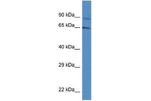 WB Suggested Anti-MUS81 AntibodyTitration: 1. (MUS81 antibody  (Middle Region))