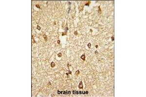 Formalin-fixed and paraffin-embedded human brain tissue reacted with DLX2 Antibody (Center), which was peroxidase-conjugated to the secondary antibody, followed by DAB staining. (DLX2 antibody  (AA 194-222))