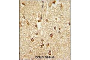 Formalin-fixed and paraffin-embedded human brain tissue reacted with DLX2 Antibody (Center), which was peroxidase-conjugated to the secondary antibody, followed by DAB staining. (DLX2 antibody  (AA 194-222))