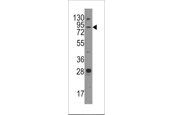 Junctophilin 3 antibody  (AA 549-578)