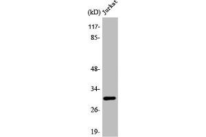 Western Blot analysis of Jurkat cells using ATF-5 Polyclonal Antibody (ATF5 antibody  (C-Term))