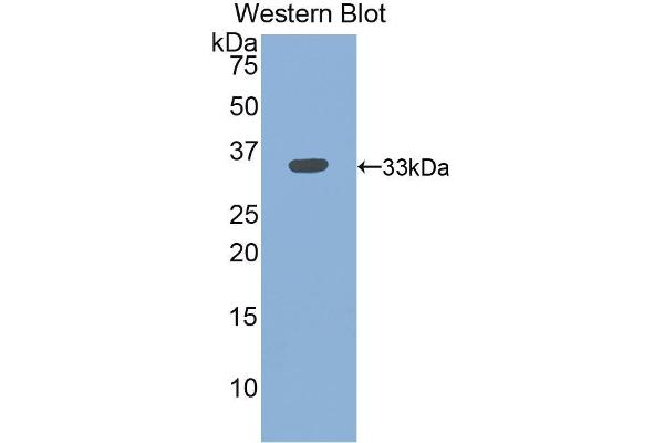 Integrin beta 3 antibody  (AA 134-376)