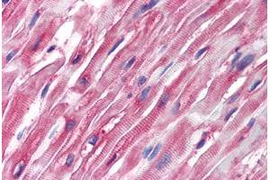 Human Heart (formalin-fixed, paraffin-embedded) stained with Tubulin, Alpha 1 (TUBA1) antibody ABIN239814 at 5 ug/ml followed by biotinylated anti-mouse IgG secondary antibody ABIN481714, alkaline phosphatase-streptavidin and chromogen. (alpha Tubulin antibody)
