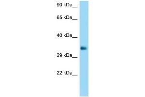 WB Suggested Anti-FCGR2B Antibody Titration: 1. (FCGR2B antibody  (C-Term))