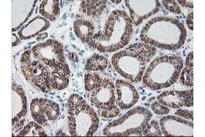 Image no. 8 for anti-Ribophorin 1 (RPN1) antibody (ABIN1500754)