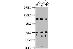 Western Blot Positive WB detected in: 293T whole cell lysate, MCF-7 whole cell lysate, 293 whole cell lysate All lanes: WDR59 antibody at 1:2000 Secondary Goat polyclonal to rabbit IgG at 1/50000 dilution Predicted band size: 110, 65, 63, 47 kDa Observed band size: 110 kDa (WDR59 antibody  (AA 619-862))