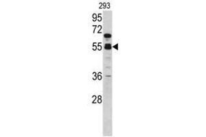 Image no. 1 for anti-Coagulation Factor X (F10) (C-Term) antibody (ABIN452984) (Coagulation Factor X antibody  (C-Term))