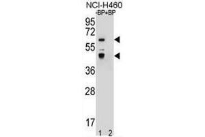Western blot analysis of PRAMEF3 Antibody (C-term) Pab pre-incubated without(lane 1) and with(lane 2) blocking peptide in NCI-H460 cell line lysate. (PRAMEF3 antibody  (C-Term))