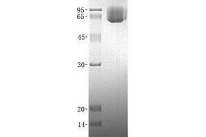 Validation with Western Blot (ICAM1 Protein (His tag))