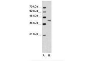 Image no. 1 for anti-Bradykinin Receptor B2 (BDKRB2) (N-Term) antibody (ABIN203497)