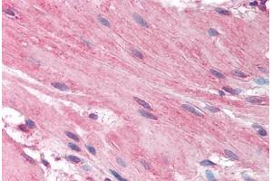 Human Small Intestine, Smooth Muscle (formalin-fixed, paraffin-embedded) stained with HRH1 antibody ABIN297157 at 2. (HRH1 antibody  (AA 471-484))