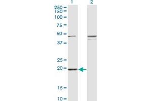 Western Blot analysis of RBBP9 expression in transfected 293T cell line by RBBP9 monoclonal antibody (M03A), clone 3H4.