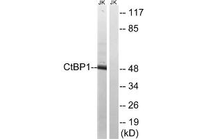 Western blot analysis of extracts from Jurkat cells, using CtBP1 (epitope around residue 422) antibody. (CTBP1 antibody  (Ser422))