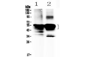 Western blot analysis of Retinal S antigen using anti-Retinal S antigen antibody .