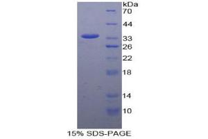SDS-PAGE analysis of Human CCDC80 Protein. (CCDC80 Protein)