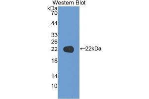 Western Blotting (WB) image for anti-Keratin 17 (KRT17) (AA 252-393) antibody (ABIN1175071) (KRT17 antibody  (AA 252-393))