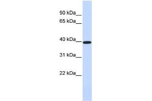 WB Suggested Anti-XRCC4 Antibody Titration:  0. (XRCC4 antibody  (Middle Region))